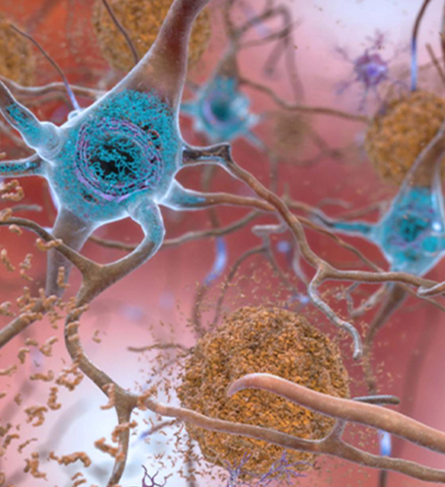 BREAKING! New Study Reveals: A Simple Action Can Clear Brain Toxins and Effectively Prevent Alzheime