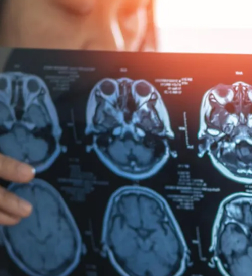 Australia’s Alzheimer’s Cases Skyrocket, But These Jobs Have the Lowest Risk of Developing the Disea